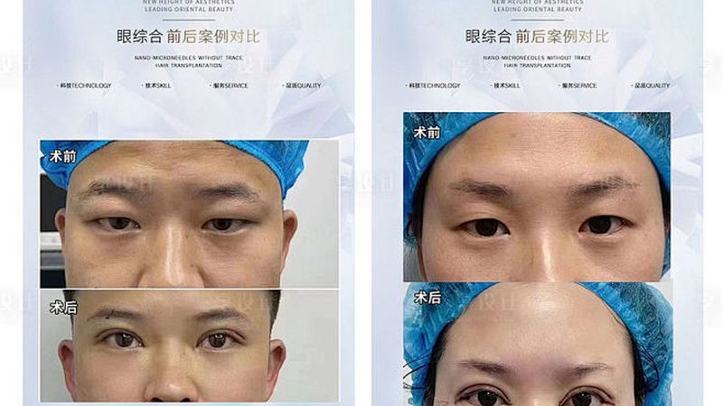 轻医美加盟设备采购清单
