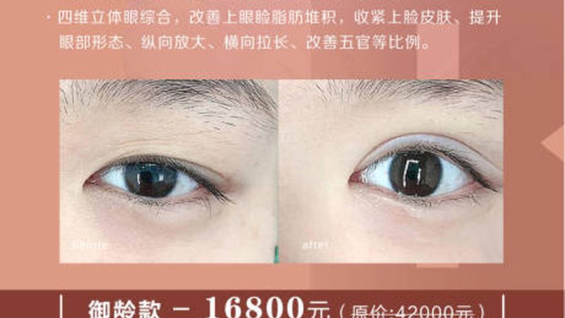 西安磨骨手术，医生排名的真实含义