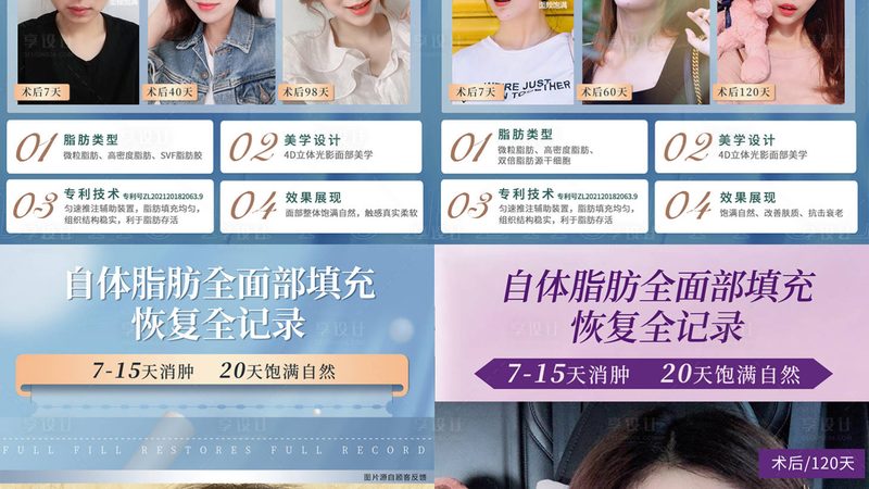 美容院蛋白线批发，揭秘其背后的技术秘密与选购要点