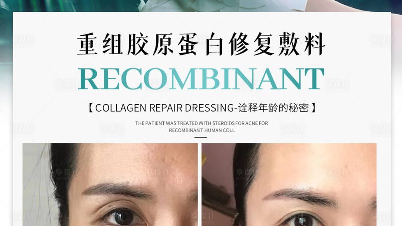 面部医美项目，副作用真的那么可怕吗？**
