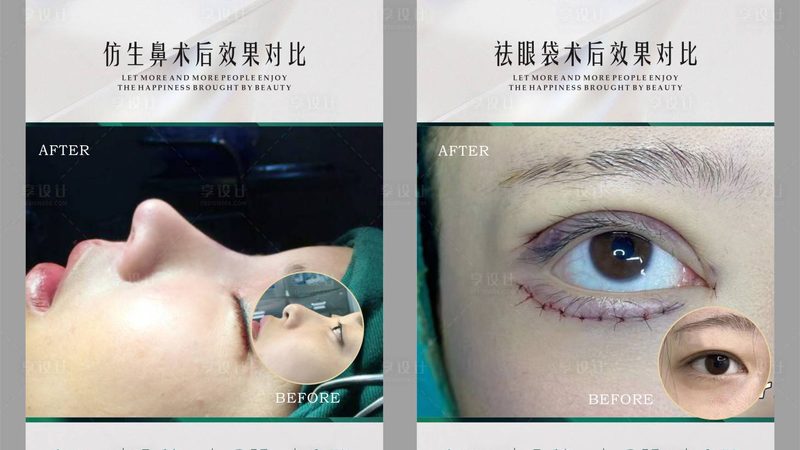 上海玻尿酸批发价格表