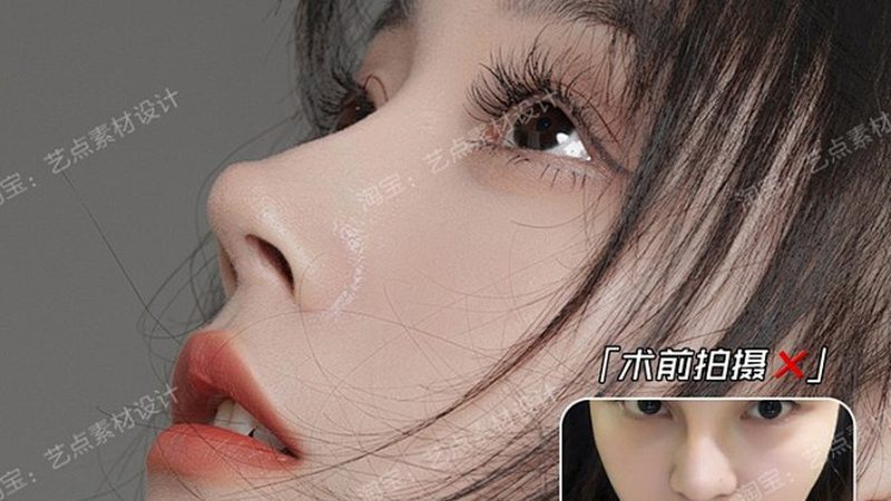 埋线提升，厂家直销与代理商有何不同？**