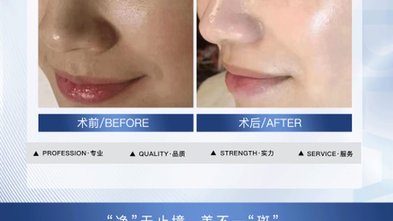 小标题：售后服务的重要性