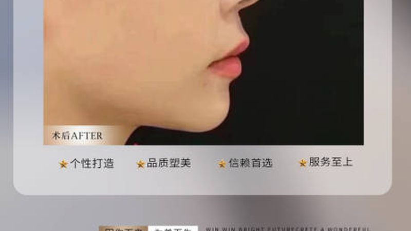 皮肤管理仪器材质与尺寸：揭秘背后的秘密
