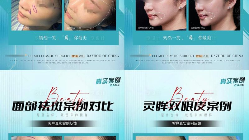 轻医美产品厂家，谁在真正掌控质量