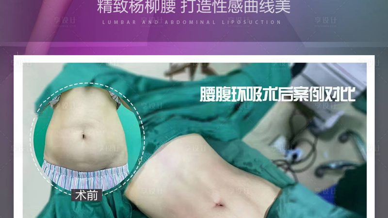 广州注射美容材料批发市场：揭秘高品质美容材料的选购之道**