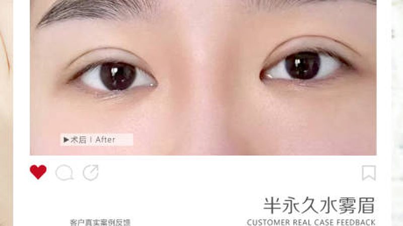 医美咨询师新手需要什么证书