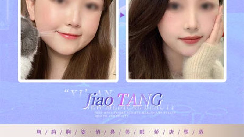 皮肤管理仪器定制：从贴牌到研发，行业正在经历什么