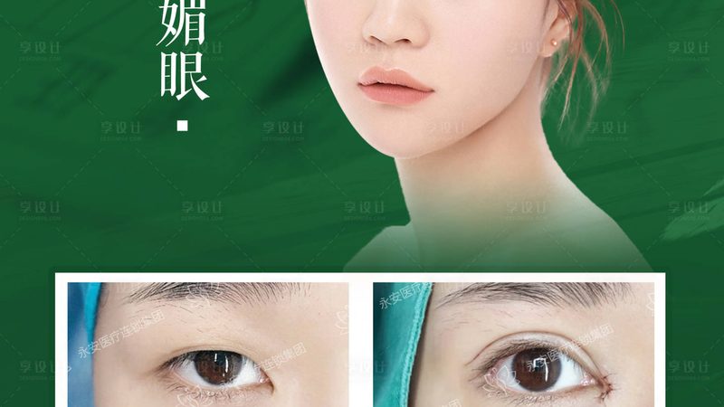 隆鼻术后鼻头变硬？了解软化过程，安心恢复**