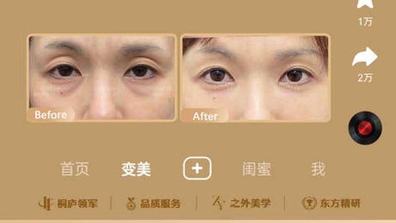 小标题：咬肌肥大，成因与影响