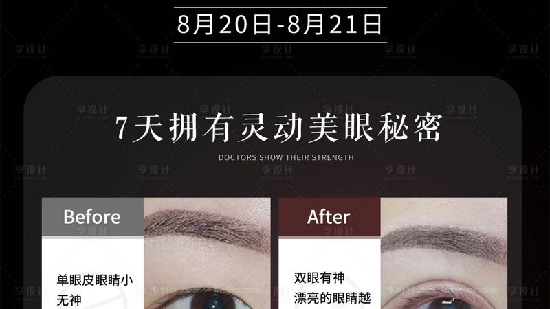 激光祛痘印恢复期多久？揭秘激光治疗全过程