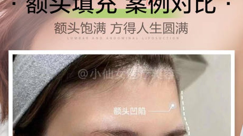 隆鼻假体取出，费用构成揭秘**